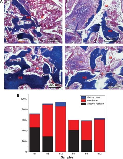 Aberrant Paracrine Signalling For Bone Remodelling Off