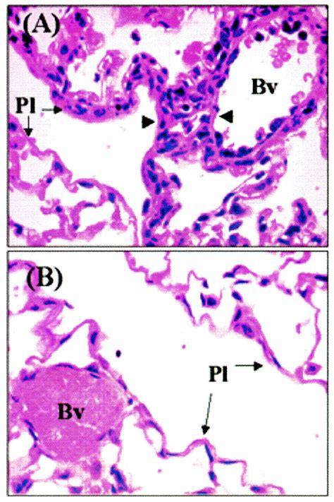 Role Of HtrA In The Virulence And Competence Of Streptococcus