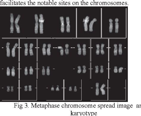 Figure 1 From Efficient Feature Extraction And Classification Of Chromosomes Semantic Scholar