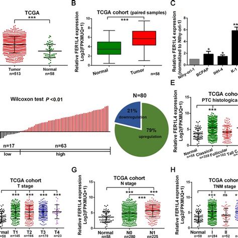 Fer1l4 Was Upregulated In Ptc And Associated With Later Stage Diseases