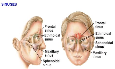 Pin by Phyllis Griffiths on Headaches from Hell | Sinus headache ...