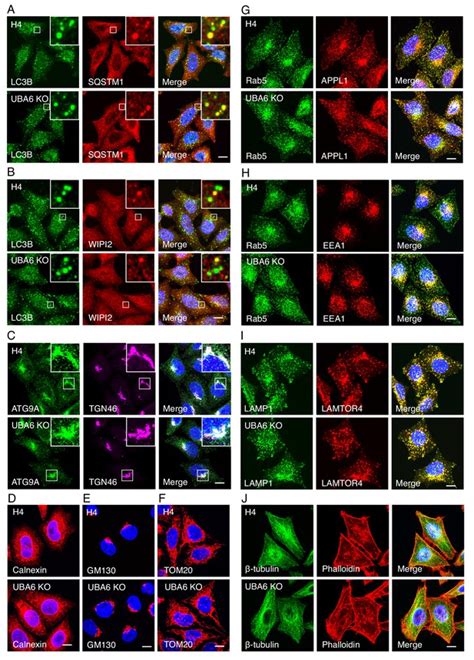 Figures And Data In Negative Regulation Of Autophagy By UBA6 BIRC6