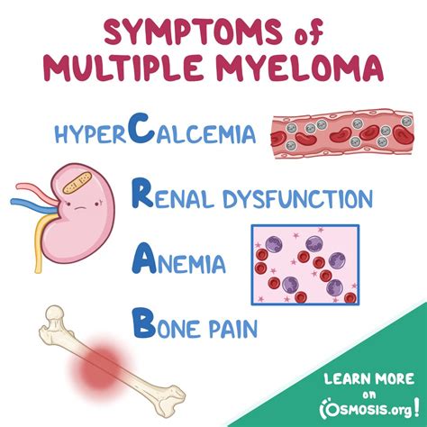 Osmosis On Twitter Multiple Myeloma Is A Cancer Of Plasma Cells That