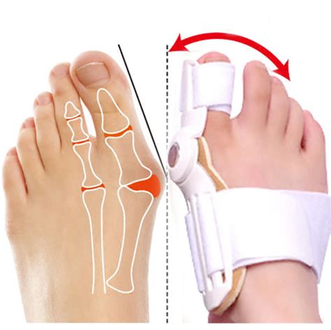 Ripley F Rula Correctora Unidad Para Hallux Valgus Juanete