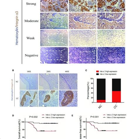 Integrin Is Frequently Upregulated In Cervical Cancer Tissue And