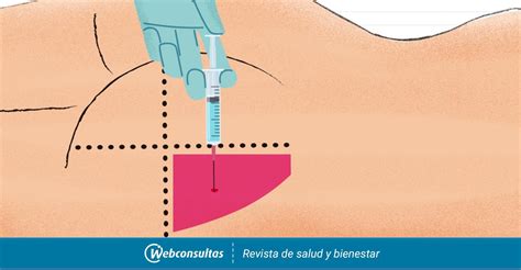 Barricada Dorado Vela Cuales Son Las Inyecciones Intramusculares Mojado