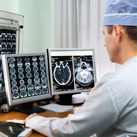 acute stroke care world stroke organization