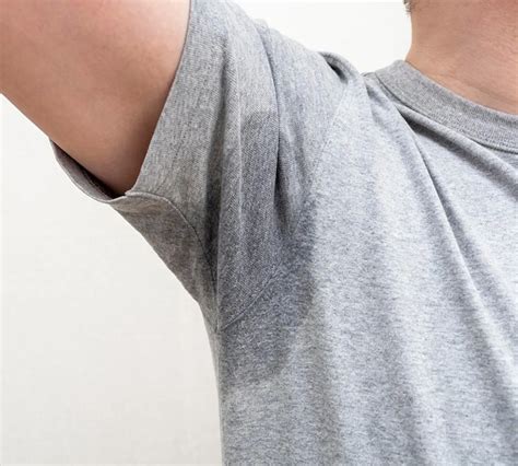 Excessive Sweating | Smyrna MED - Medical Health Tourism