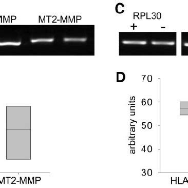 Expression Of MT MMP MRNAs In Human First Trimester Trophoblasts A