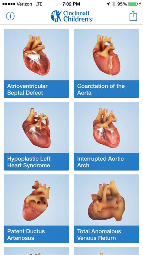 Congenital Heart Defects Types