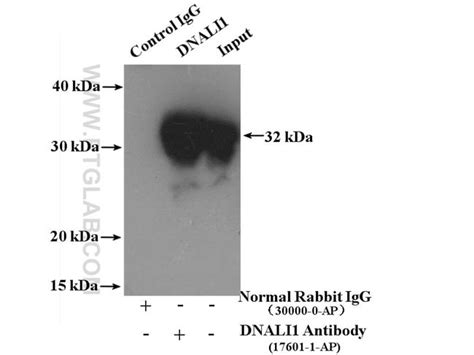 Dnali1 Rabbit Anti Human Mouse Rat Polyclonal Proteintech 150 μl