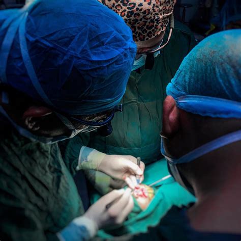 The Surgical Blueprint How Cheiloplasty Reshapes Lives And Restores Function