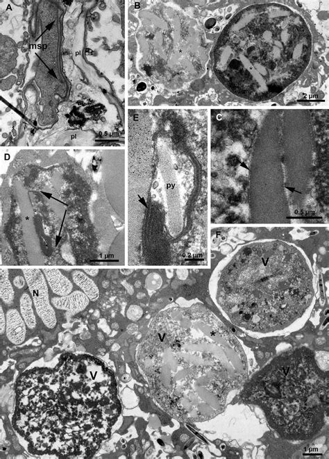 Transmission electron microscopy of (A–E) Ornithocercus magnificus and... | Download Scientific ...