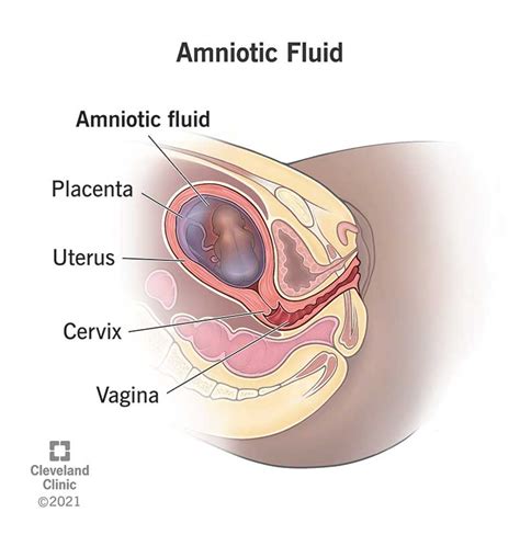 Amnion Ultrasound