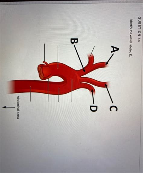 Solved Identify The Vessel Labeled D A B Abdominal Chegg