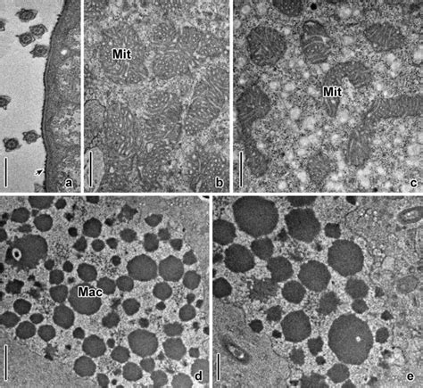 Tem Observation Of E Aediculatus From The Cuonps Group A The Pellicle