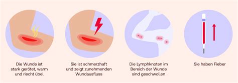 Wundheilung Beschleunigen Shop Apotheke