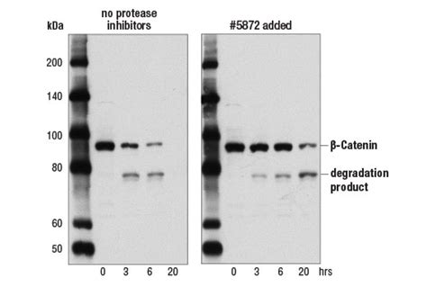 Protease Phosphatase Inhibitor Cocktail X Cell Signaling Technology