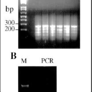 Ethidium Bromide Stained Agarose Gels Showing Yields And Quality Of Dna