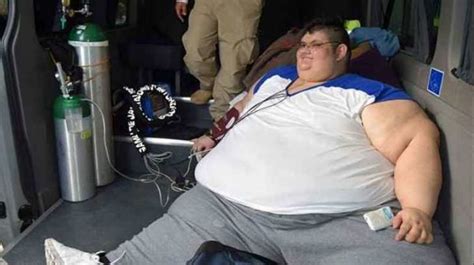 Juan Pedro el hombre más obeso del mundo bajó 170 kilos