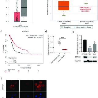 CRTAC1 Inhibits Bladder Cancer Cell Proliferation Migration Invasion