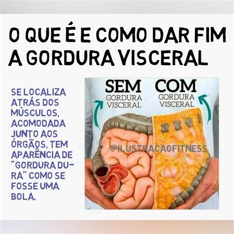 O Que Gordura Perivesical E Das Fossas Isquiorretais Plano De Aula