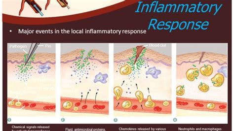 Inflammation Or Inflammatory Barrier Of Immune System Online Biology