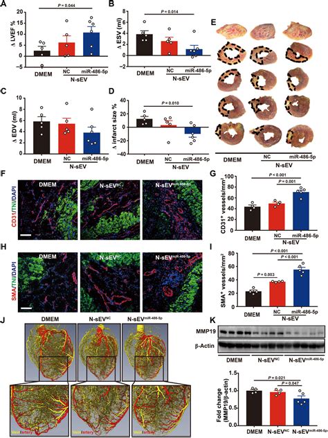 Small Extracellular Vesicles Containing Mir 486 5p Promote Angiogenesis After Myocardial