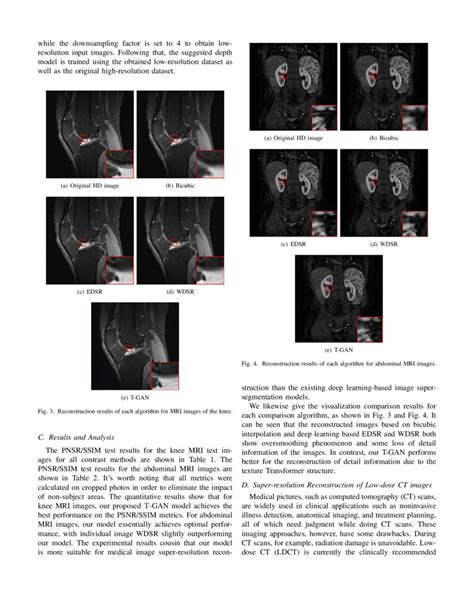 Transformer And GAN Based Super Resolution Reconstruction Network For