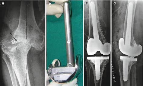 Musculoskeletal Key