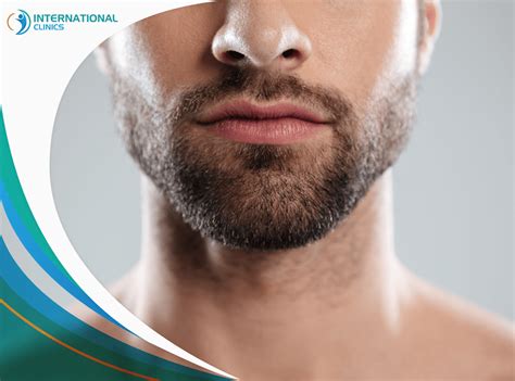 Beard Transplant In Turkey Great Advantages Low Costs 2024