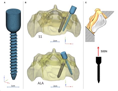 Virtual Pedicle Screw Insertion Into The Patient Specific Sacrum