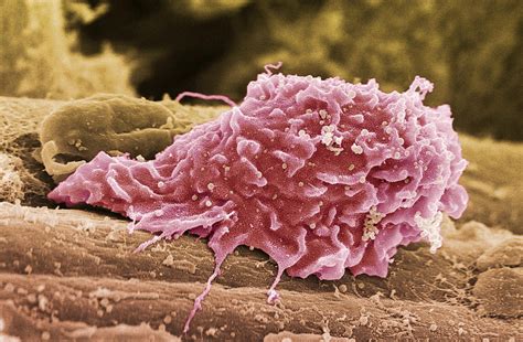 Macrophage White Blood Cell Sem Photograph By Steve Gschmeissner Pixels