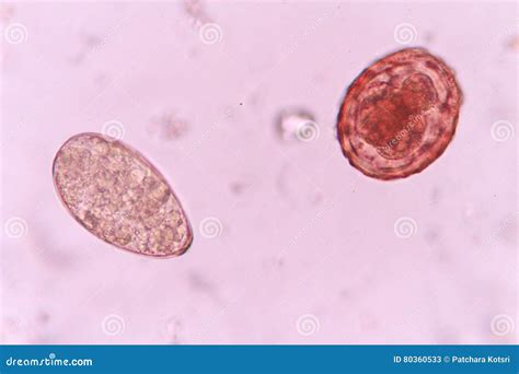 Parasites In Stool Microscope