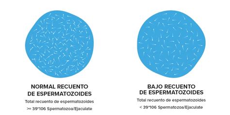 Ilustración De La Diferencia Entre Un Recuento De Espermatozoides