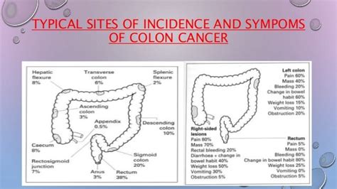 Colon cancer