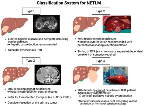 Jcm Free Full Text Defining A New Classification System For The