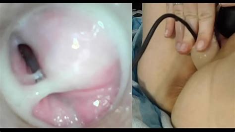 Sexo Anal Coceira Vagina Porno Tarado