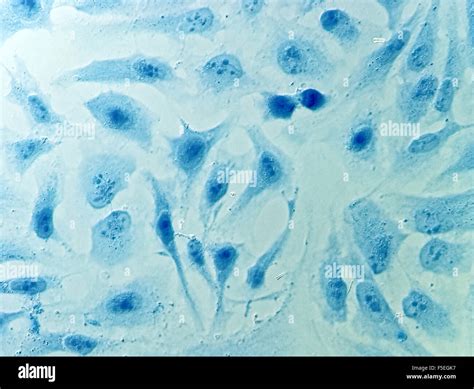 HeLa Cervical Cancer Cells Stained With Coomassie Blue Under Stock