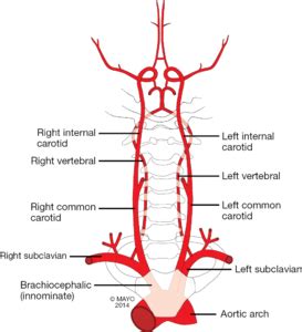 Intro To Vascular Test 1 Carotids The Vascular S Pretty Coo Vershz