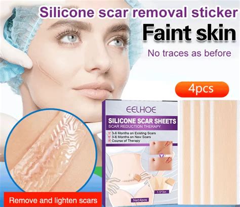 Silicone Scar Removal Sticker Lazada PH