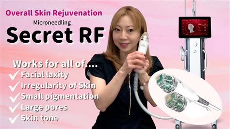 Micro Needling Secret Rf 【explain Overall Skin Rejuvenation Anti Aging Treatment】 Youtube