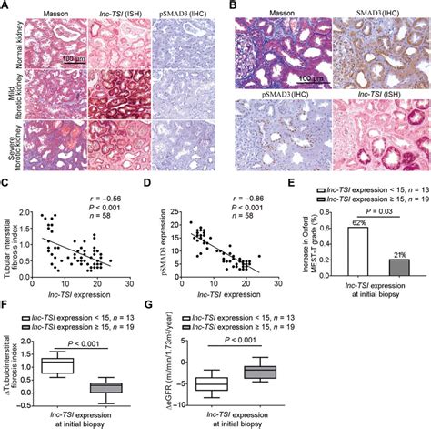 Long Noncoding RNA Lnc TSI Inhibits Renal Fibrogenesis By Negatively