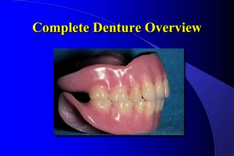 Ppt Complete Denture Overview Powerpoint Presentation Free Download Id248665