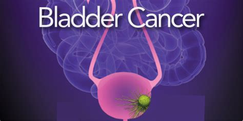 Understanding Bladder Cancer Risk Factors Symptoms And Treatment