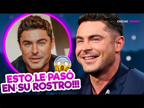 La transformación de Zac Efron Antes y después de su impactante cambio