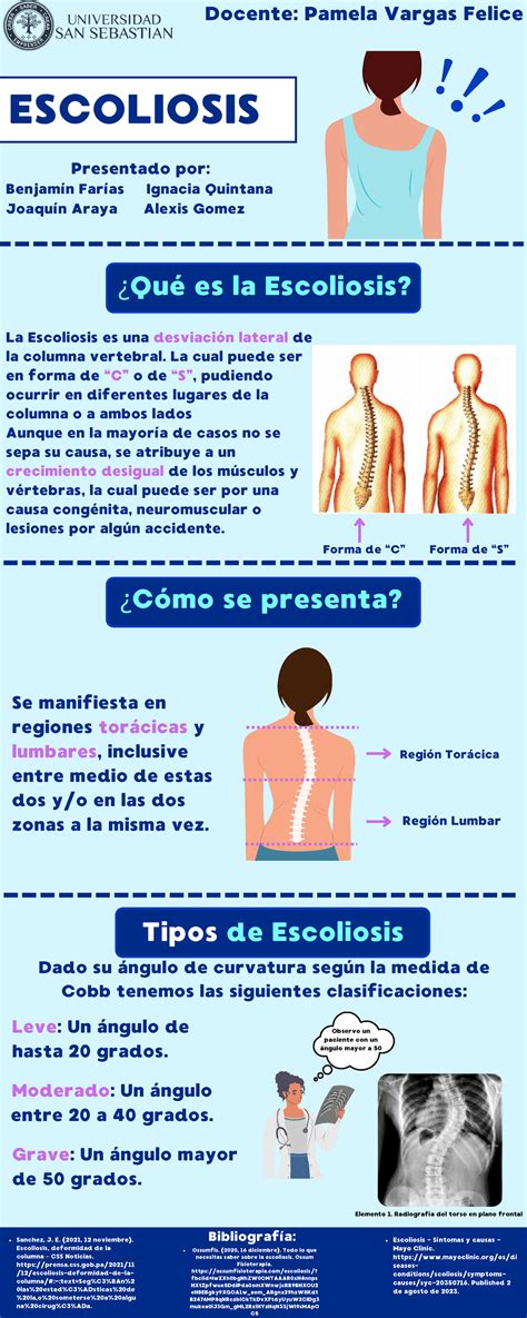 Infografía sobre la Escoliosis ESCOLIOSIS Presentado por Benjamín