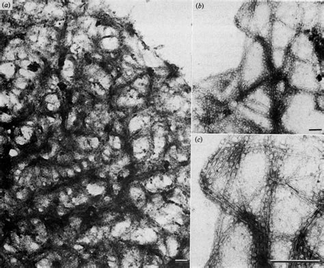 Transmission Electron Micrographs Of Negatively Stained Preparations Of