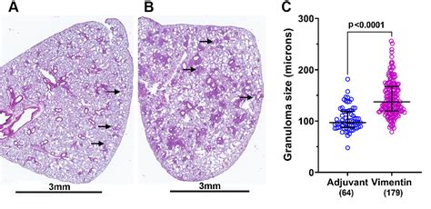 Figure 2 From Systemic Immune Response To Vimentin And Granuloma