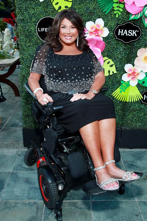 Descubrir 101 Imagen Why Is Abby Lee In A Wheelchair Abzlocalmx